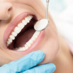 The Best Treatment to Restore Your Smile