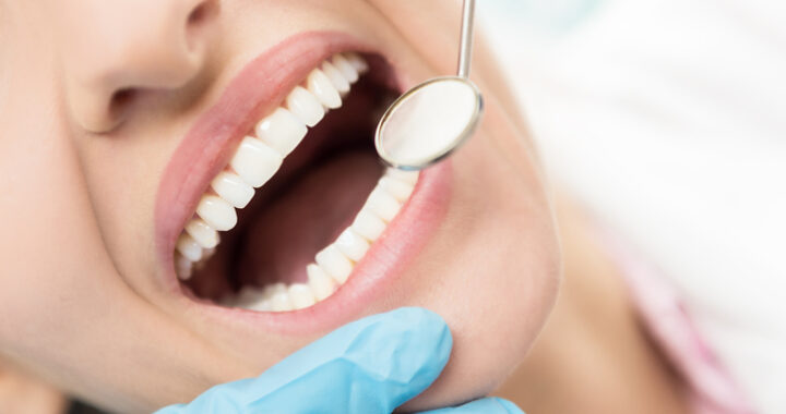 The Best Treatment to Restore Your Smile